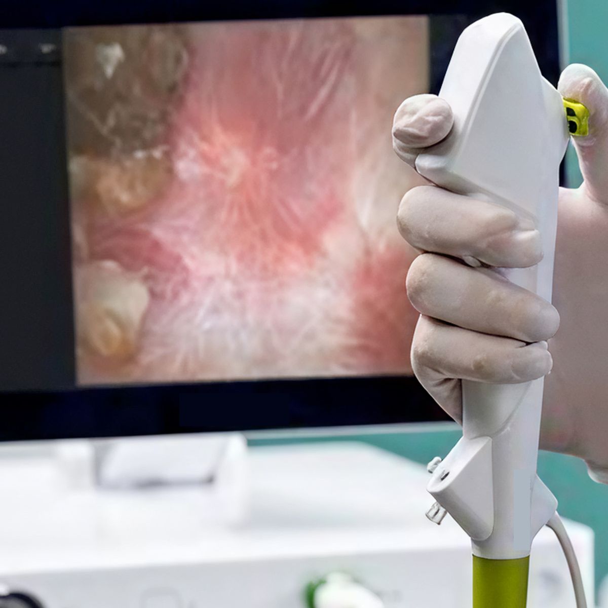 aScope™ 5 Uretero – Ureteroscopio flexible single-use