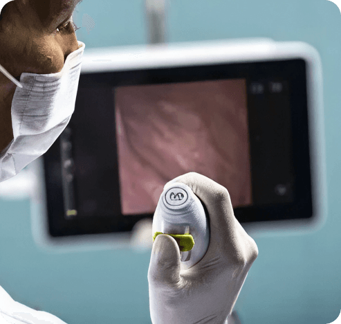 Consumibles (Cistoscopios y ureteroscopios)