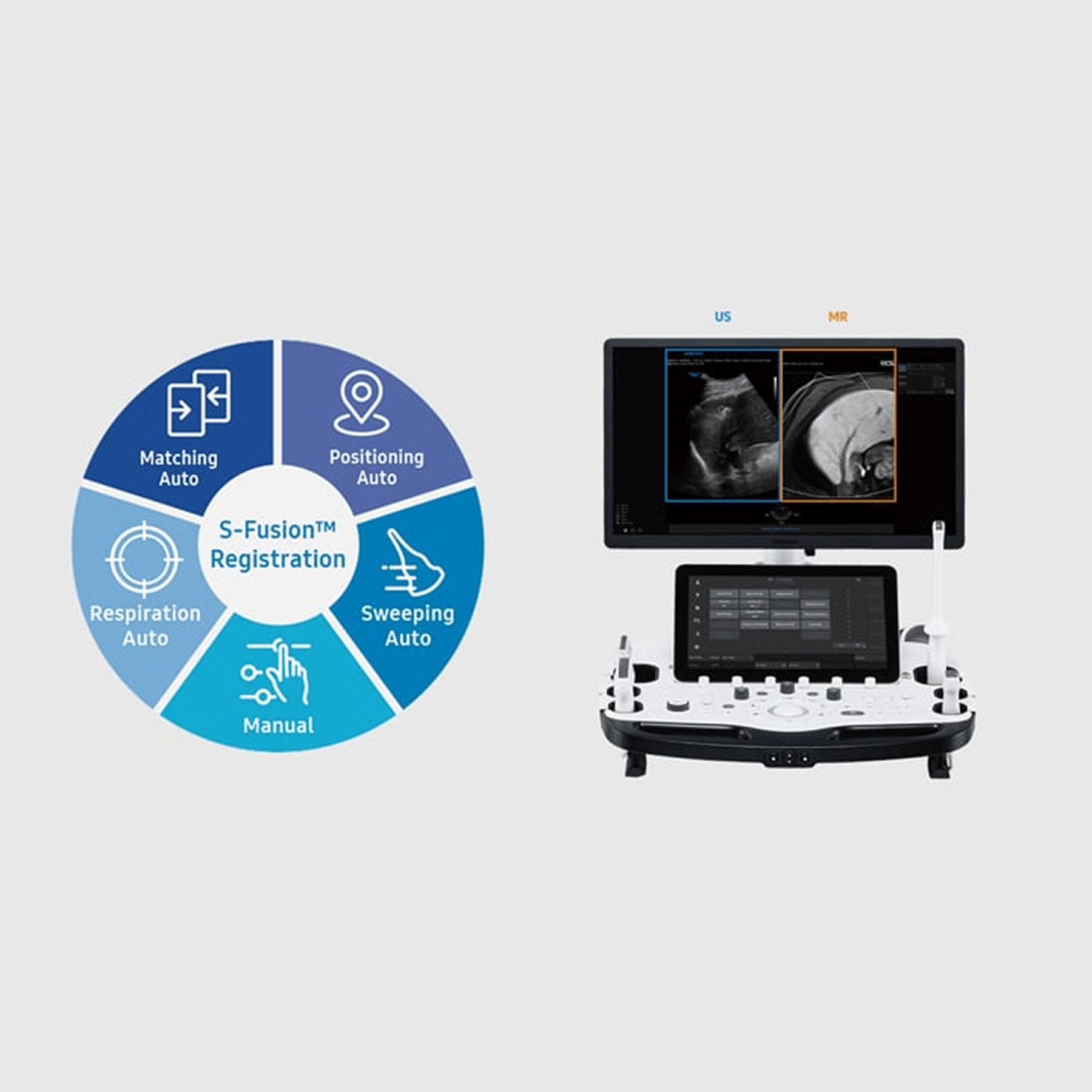 RS85 - Ultrasonido de mama