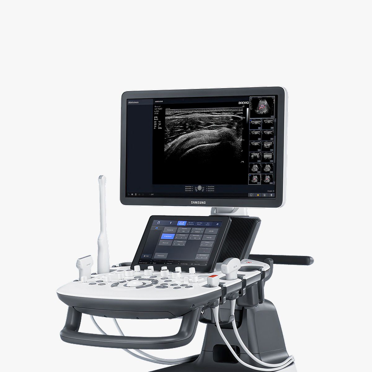 V4 – Ultrasonido ginecológico para consulta
