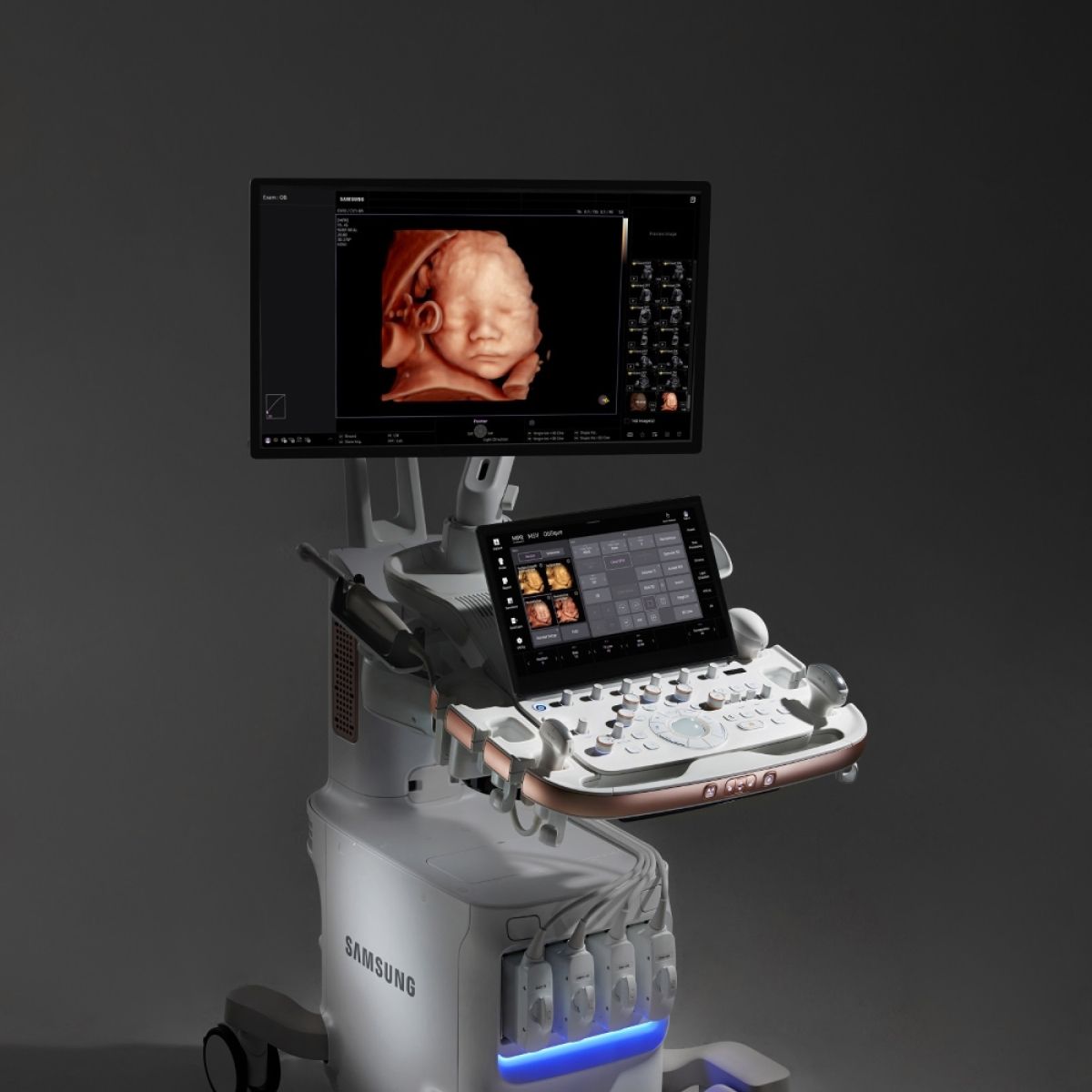 V4 – Ultrasonido ginecológico para consulta