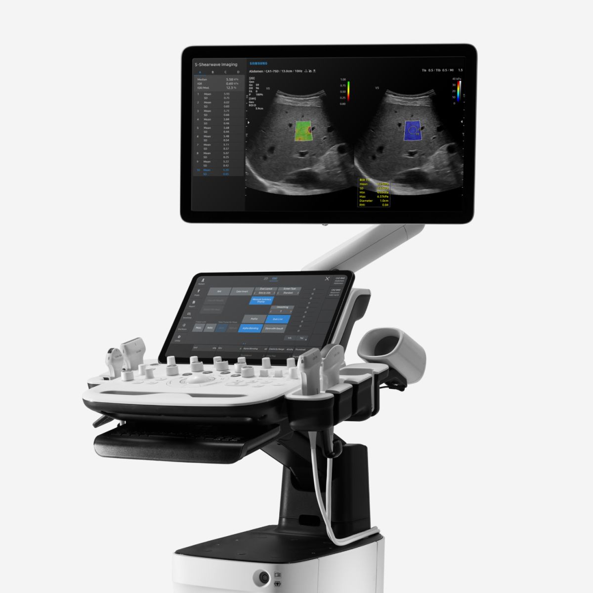 V5 – Ultrasonido ginecológico de precisión accesible