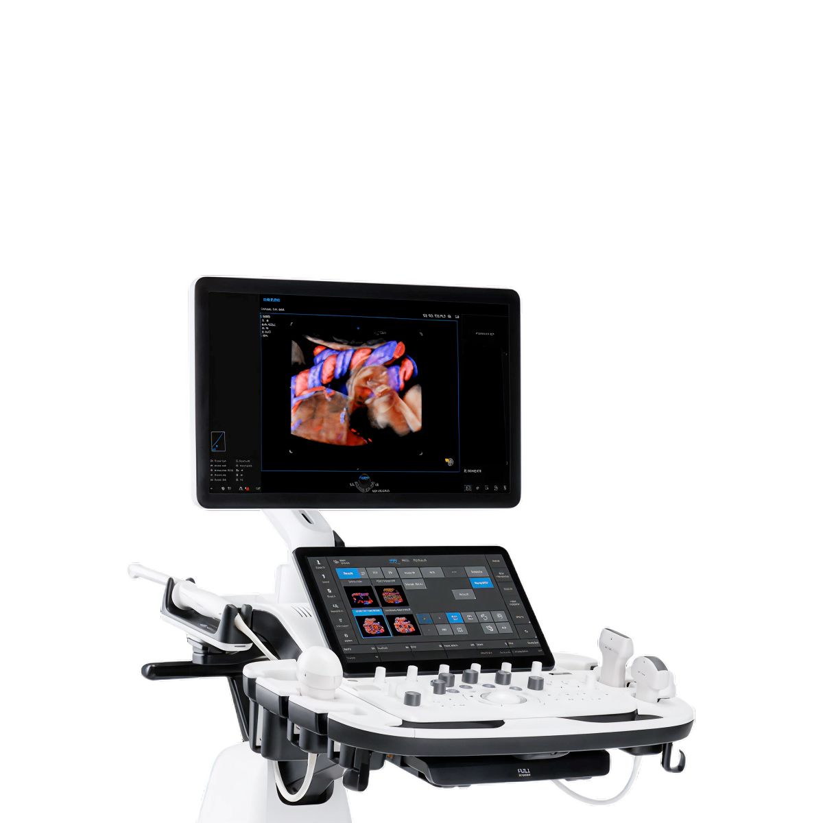 V6 – Ultrasonido ginecológico de alto desempeño